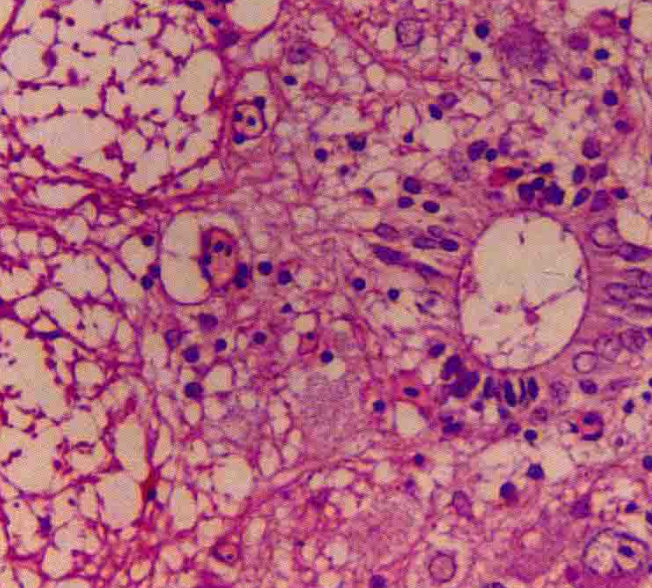 The transverse of spinal cord